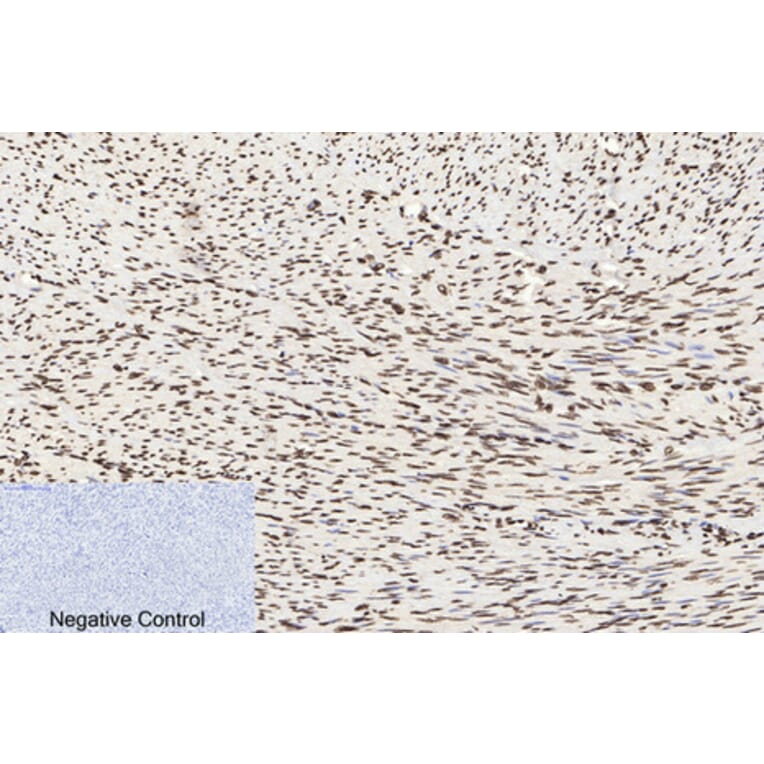 Immunohistochemistry - Anti-Histone H3 (acetyl Lys9) Antibody (D0006) - Antibodies.com