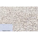 Immunohistochemistry - Anti-Histone H3 (acetyl Lys9) Antibody (D0006) - Antibodies.com