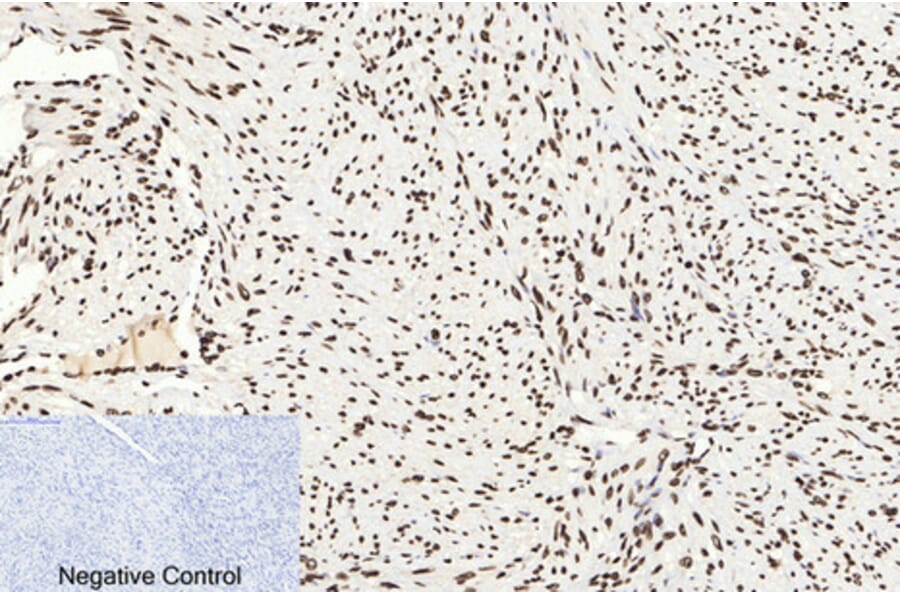 Immunohistochemistry - Anti-Histone H3 (acetyl Lys9) Antibody (D0006) - Antibodies.com