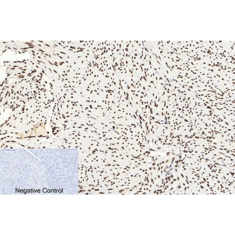 Immunohistochemistry - Anti-Histone H3 (acetyl Lys9) Antibody (D0006) - Antibodies.com