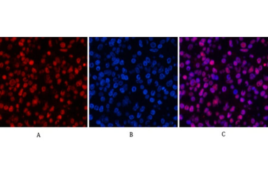 Immunofluorescence - Anti-Histone H3 (acetyl Lys9) Antibody (D0006) - Antibodies.com