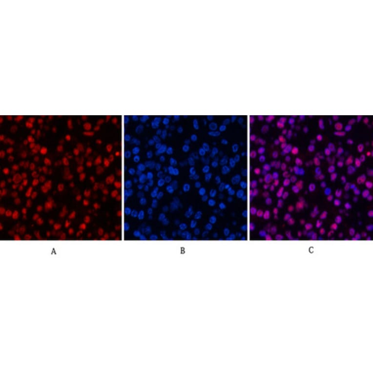 Immunofluorescence - Anti-Histone H3 (acetyl Lys9) Antibody (D0006) - Antibodies.com