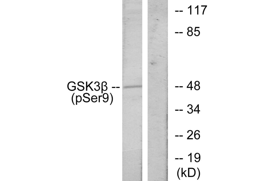 Western Blot - Anti-GSK3 beta (phospho Ser9) Antibody (A7098) - Antibodies.com