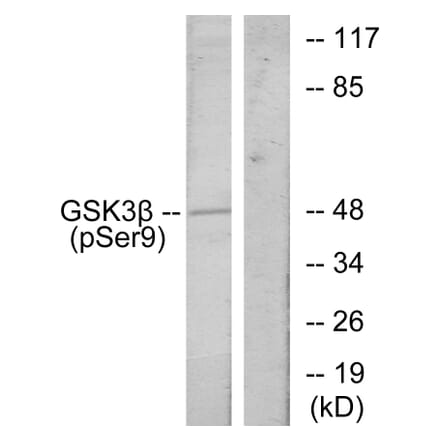 Western Blot - Anti-GSK3 beta (phospho Ser9) Antibody (A7098) - Antibodies.com