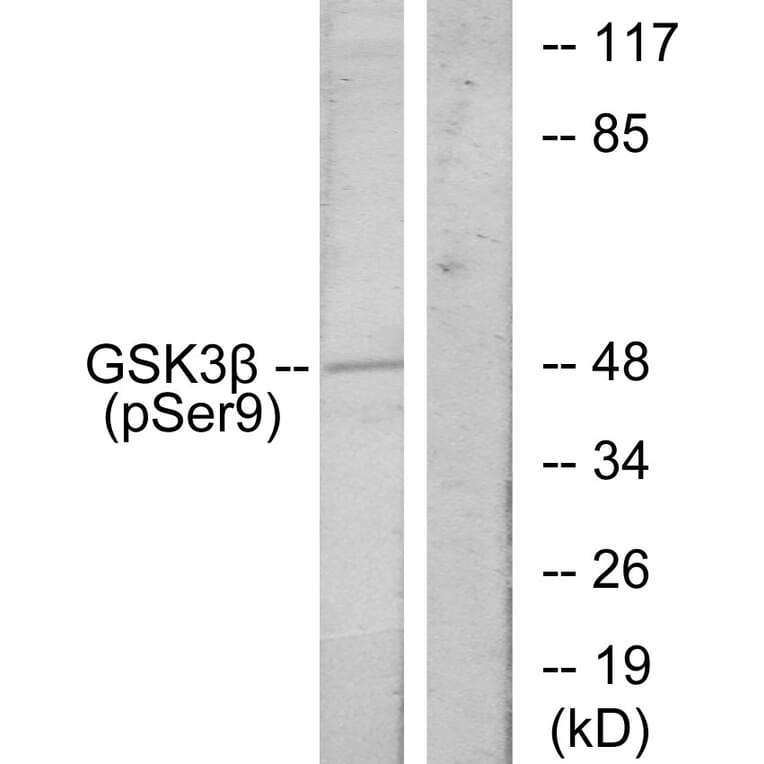 Western Blot - Anti-GSK3 beta (phospho Ser9) Antibody (A7098) - Antibodies.com