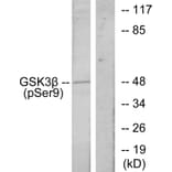 Western Blot - Anti-GSK3 beta (phospho Ser9) Antibody (A7098) - Antibodies.com
