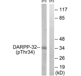 Western Blot - Anti-DARPP-32 (phospho Thr34) Antibody (A7056) - Antibodies.com