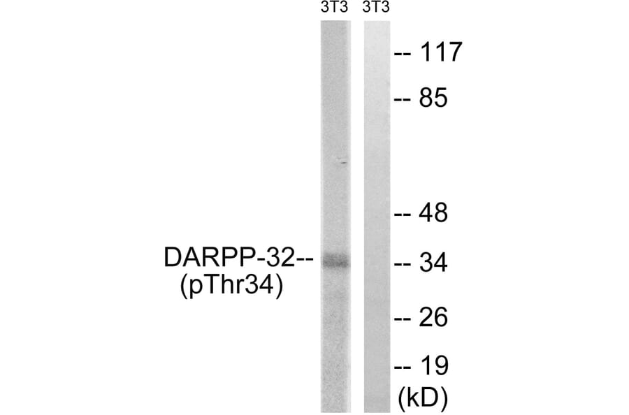 Western Blot - Anti-DARPP-32 (phospho Thr34) Antibody (A7056) - Antibodies.com