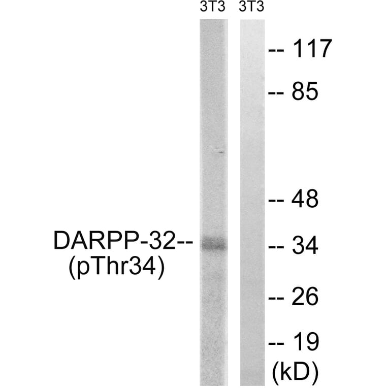 Western Blot - Anti-DARPP-32 (phospho Thr34) Antibody (A7056) - Antibodies.com