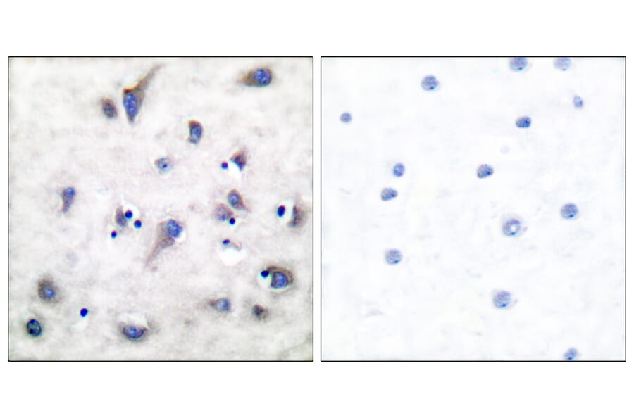 Immunohistochemistry - Anti-DARPP-32 (phospho Thr34) Antibody (A7056) - Antibodies.com