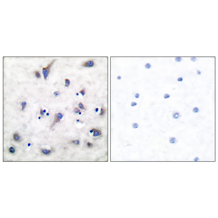Immunohistochemistry - Anti-DARPP-32 (phospho Thr34) Antibody (A7056) - Antibodies.com