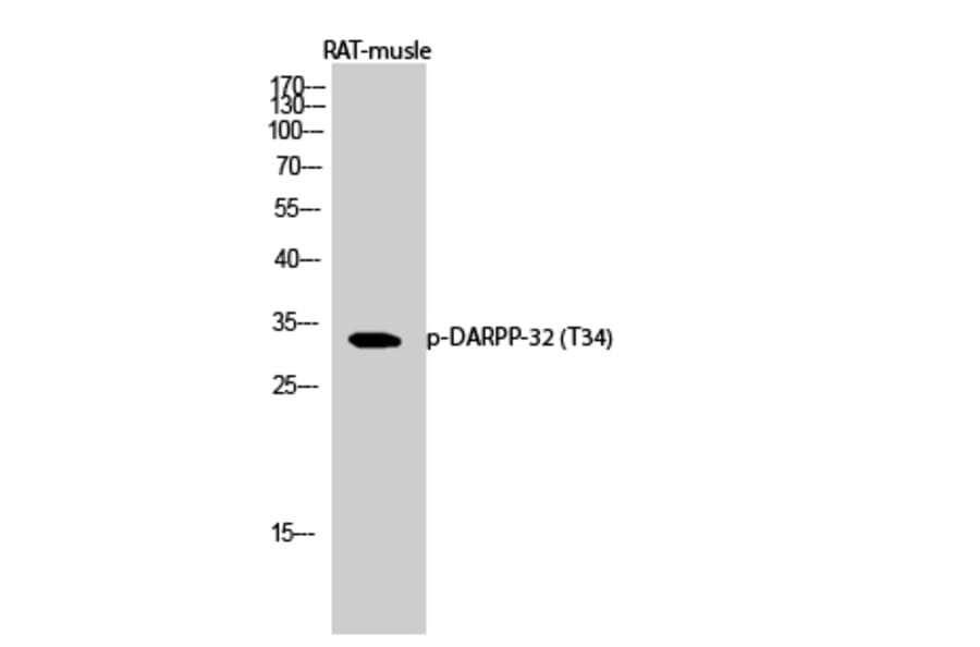 Western Blot - Anti-DARPP-32 (phospho Thr34) Antibody (A7056) - Antibodies.com