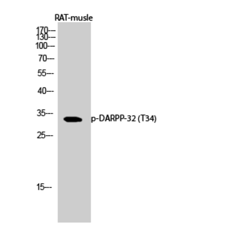 Western Blot - Anti-DARPP-32 (phospho Thr34) Antibody (A7056) - Antibodies.com