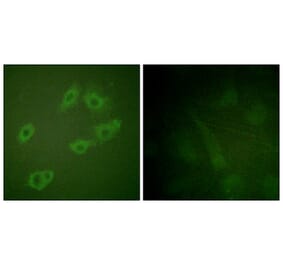 Immunofluorescence - Anti-HER3 (phospho Tyr1222) Antibody (A0944) - Antibodies.com