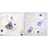 Immunohistochemistry - Anti-HER3 (phospho Tyr1222) Antibody (A0944) - Antibodies.com