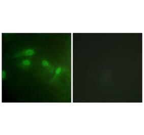 Immunofluorescence - Anti-MDM2 (phospho Ser186+Ser188) Antibody (A1154) - Antibodies.com