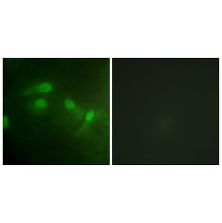 Immunofluorescence - Anti-MDM2 (phospho Ser186+Ser188) Antibody (A1154) - Antibodies.com