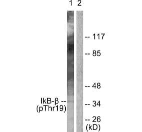 Western Blot - Anti-IkappaB-beta (phospho Thr19) Antibody (A0438) - Antibodies.com
