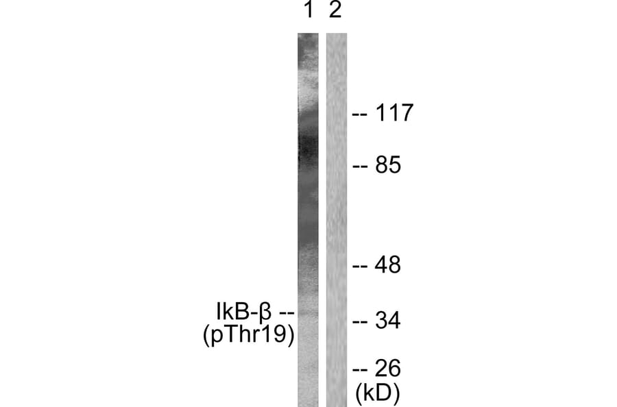 Western Blot - Anti-IkappaB-beta (phospho Thr19) Antibody (A0438) - Antibodies.com