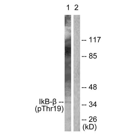 Western Blot - Anti-IkappaB-beta (phospho Thr19) Antibody (A0438) - Antibodies.com