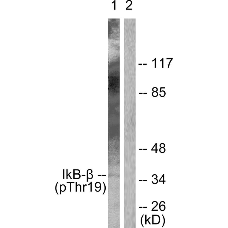 Western Blot - Anti-IkappaB-beta (phospho Thr19) Antibody (A0438) - Antibodies.com