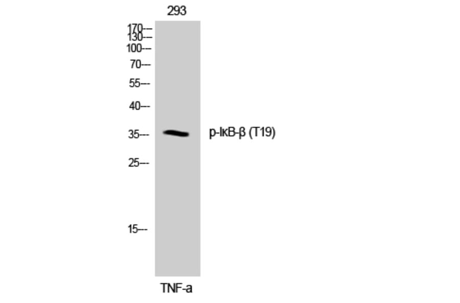 Western Blot - Anti-IkappaB-beta (phospho Thr19) Antibody (A0438) - Antibodies.com