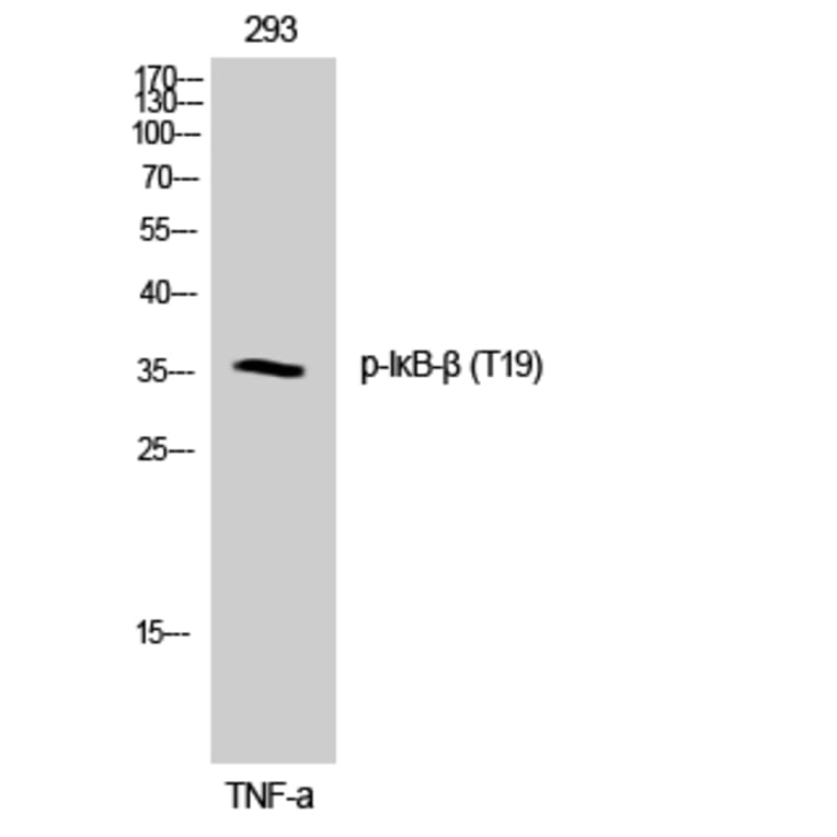 Western Blot - Anti-IkappaB-beta (phospho Thr19) Antibody (A0438) - Antibodies.com