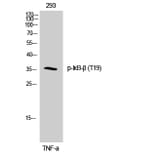 Western Blot - Anti-IkappaB-beta (phospho Thr19) Antibody (A0438) - Antibodies.com