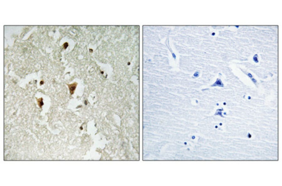 Immunohistochemistry - Anti-IkappaB-beta (phospho Thr19) Antibody (A0438) - Antibodies.com
