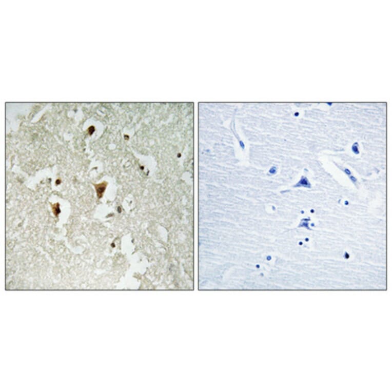 Immunohistochemistry - Anti-IkappaB-beta (phospho Thr19) Antibody (A0438) - Antibodies.com