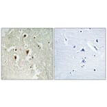 Immunohistochemistry - Anti-IkappaB-beta (phospho Thr19) Antibody (A0438) - Antibodies.com