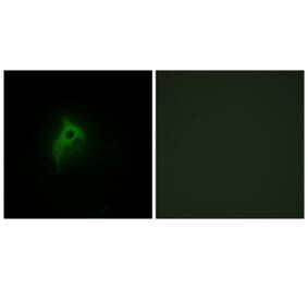 Immunofluorescence - Anti-Adrenergic Receptor alpha-2B Antibody (C10415) - Antibodies.com