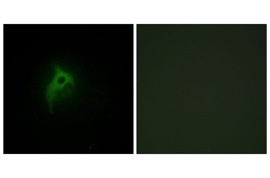 Immunofluorescence - Anti-Adrenergic Receptor alpha-2B Antibody (C10415) - Antibodies.com