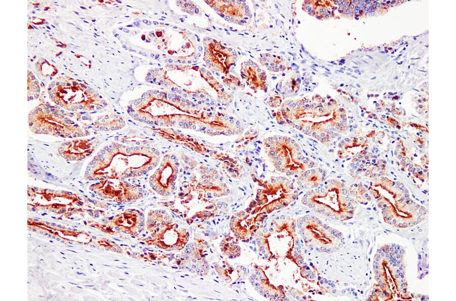 Immunohistochemistry - Anti-Prostate Specific Antigen Antibody (V0117) - Antibodies.com