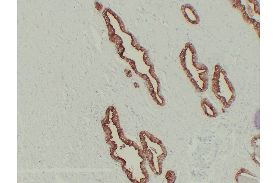 Immunohistochemistry - Anti-Prostate Specific Antigen Antibody (V0117) - Antibodies.com
