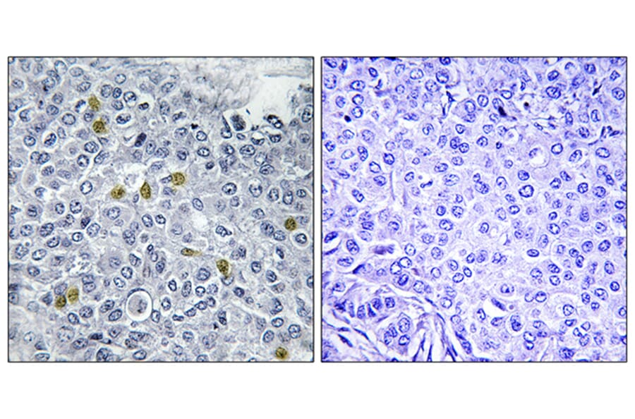 Immunohistochemistry - Anti-TOP2A (phospho Ser1106) Antibody (A1130) - Antibodies.com