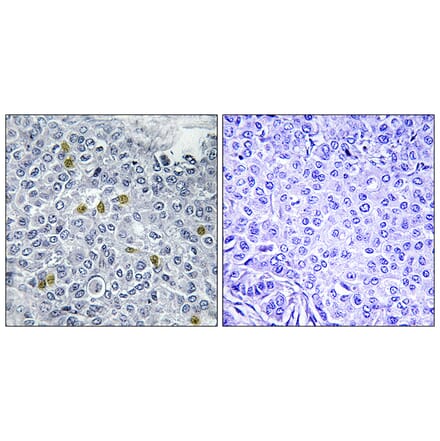 Immunohistochemistry - Anti-TOP2A (phospho Ser1106) Antibody (A1130) - Antibodies.com