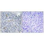 Immunohistochemistry - Anti-TOP2A (phospho Ser1106) Antibody (A1130) - Antibodies.com
