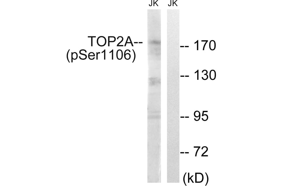 Western Blot - Anti-TOP2A (phospho Ser1106) Antibody (A1130) - Antibodies.com