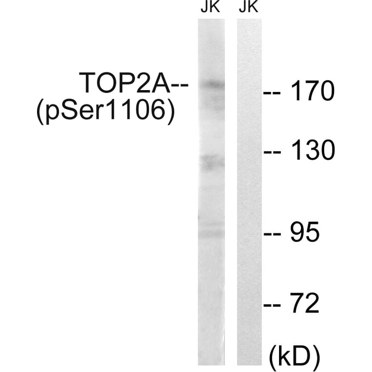 Western Blot - Anti-TOP2A (phospho Ser1106) Antibody (A1130) - Antibodies.com