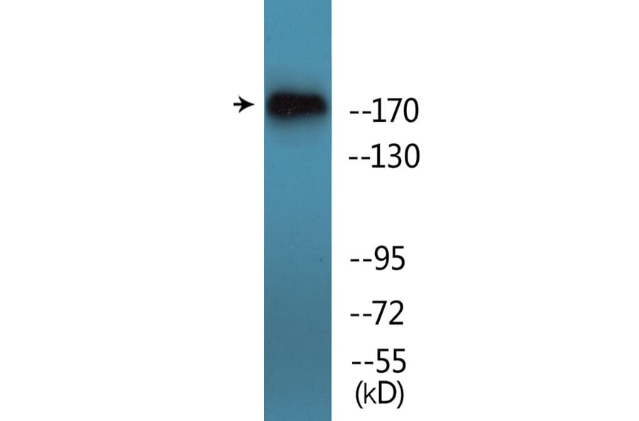 Western Blot - Anti-TOP2A (phospho Ser1106) Antibody (P12-1190) - Antibodies.com