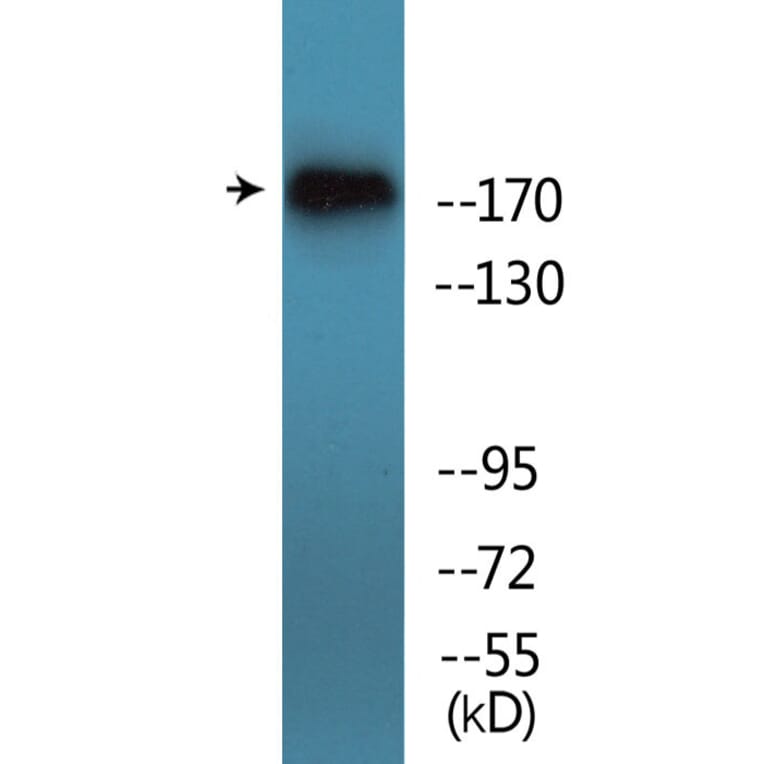 Western Blot - Anti-TOP2A (phospho Ser1106) Antibody (P12-1190) - Antibodies.com
