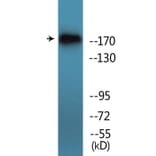 Western Blot - Anti-TOP2A (phospho Ser1106) Antibody (P12-1190) - Antibodies.com