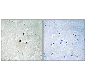 Immunohistochemistry - Anti-TIF-IA (phospho Ser649) Antibody (A8433) - Antibodies.com
