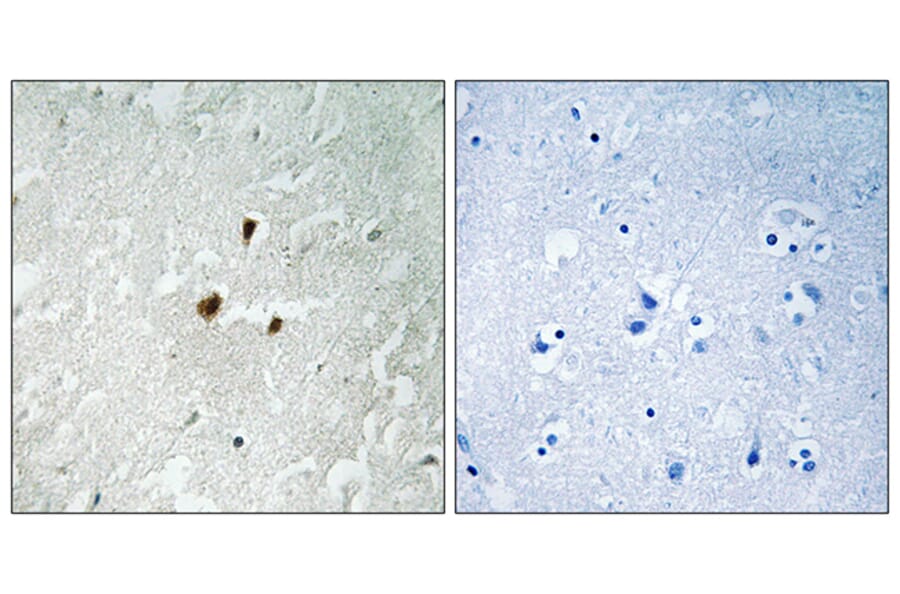 Immunohistochemistry - Anti-TIF-IA (phospho Ser649) Antibody (A8433) - Antibodies.com