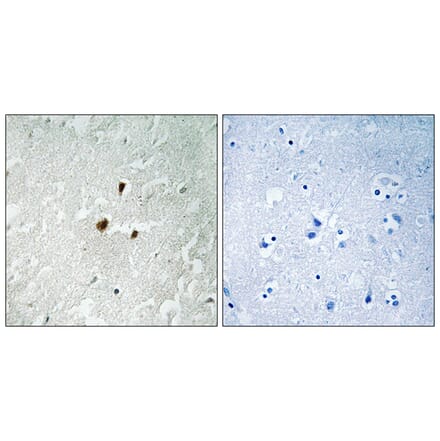 Immunohistochemistry - Anti-TIF-IA (phospho Ser649) Antibody (A8433) - Antibodies.com