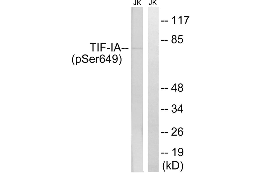 Western Blot - Anti-TIF-IA (phospho Ser649) Antibody (A8433) - Antibodies.com