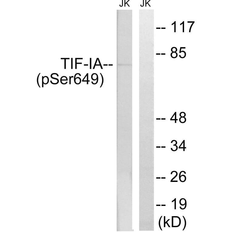 Western Blot - Anti-TIF-IA (phospho Ser649) Antibody (A8433) - Antibodies.com