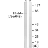 Western Blot - Anti-TIF-IA (phospho Ser649) Antibody (A8433) - Antibodies.com