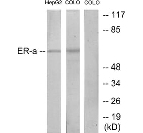 Western Blot - Anti-Estrogen Receptor-alpha Antibody (B7078) - Antibodies.com